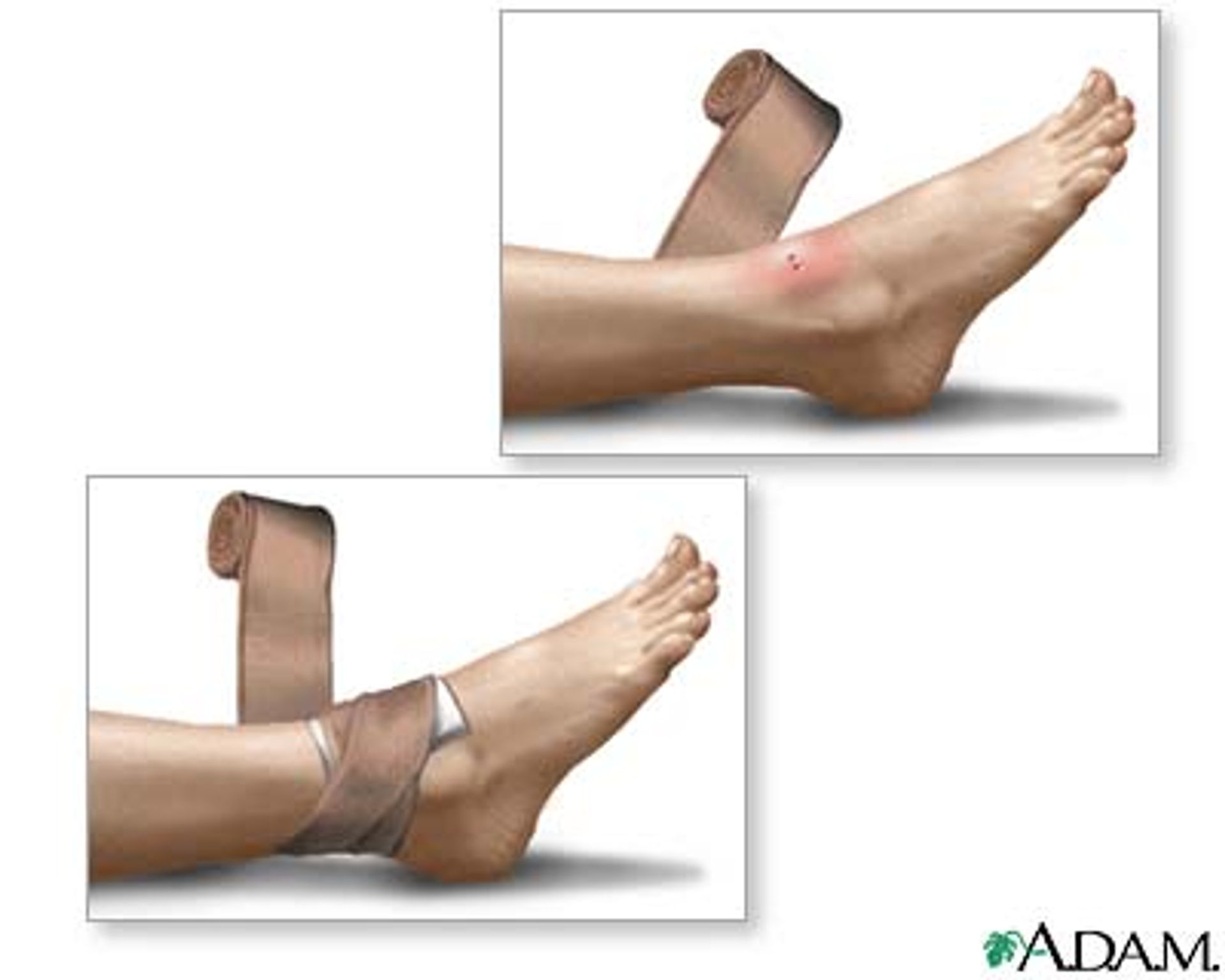 post_علاج التسمم من عضات الثعابين